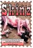 Skinz