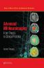 Advanced MR Neuroimaging