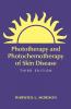 Phototherapy and Photochemotherapy for Skin Disease