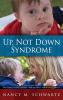 Up Not Down Syndrome
