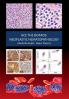 Ace The Boards: Neoplastic Hematopathology