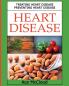 Heart Disease: Treating Heart Disease: Preventing Heart Disease (Guide to a Strong Heart Lowering Cholesterol)