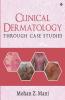Clinical Dermatology Through Case Studies