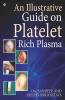 An Illustrative Guide On Platelet Rich Plasma
