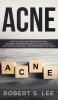Acne: How to Cure Acne through Natural Remedies and Simple Habits. Say Goodbye to Pustules Blackheads and Whiteheads for Good!