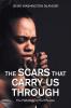 The Scars That Carry Us Through