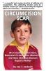 Circumcision Scar: My Foreskin Restoration Neonatal Circumcision Memories and How Christian Doctors Duped a Nation