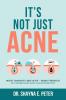 It's Not Just Acne Boost Immunity Beat Acne - Break Through to Clearer Skin & A Healthier You!