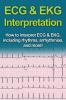 ECG & EKG Interpretation