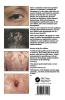 Dermatology