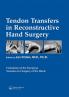 Tendon Transfers in Reconstructive Hand Surgery