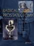 Radical Prostatectomy