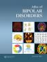 Atlas of Bipolar Disorders