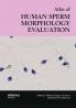 Atlas of Human Sperm Morphology Evaluation