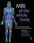 MRI of the Whole Body