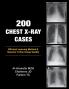 200 Chest X-Ray Cases