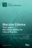 Macular Edema