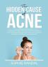 The Hidden Cause of Acne: The Essential Guide on the Cause of Acne and How to Cure it Permanently Discover the Cause and Treatments Available to Get Rid of Acne Permanently