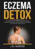 Eczema Detox: The Ultimate Guide on How to Cure Eczema Naturally Discover the Tips on How to Get Rid of Eczema Permanently and Improve Your Quality of Life