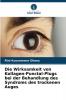 Die Wirksamkeit von Kollagen-Punctal-Plugs bei der Behandlung des Syndroms des trockenen Auges