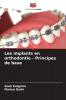 Les implants en orthodontie - Principes de base