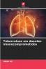Tuberculose em doentes imunocomprometidos