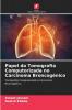 Papel da Tomografia Computorizada no Carcinoma Broncogénico