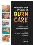 PRINCIPLES AND PRACTICE OF BURN CARE