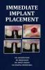Immediate Implant Placement