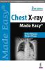 Chest X-ray Made Easy 2nd edn 2017