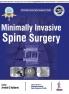 Minimally Invasive Spine Surgery