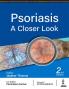 PSORIASIS: A CLOSER LOOK