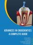 ADVANCES IN ENDODONTICS A COMPLETE GUIDE