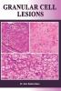 Granular Cell Lesions