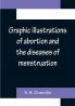Graphic illustrations of abortion and the diseases of menstruation; Consisting of Twelve Plates from Drawings Engraved on Stone and Coloured by Mr. J. Perry and Two Copper-plates from the Philosophical Transactions Coloured by the Same Artist. the Whole Representing Forty-five Specimens of Aborted Ova and Adventitious Productions of the Uterus With Preliminary Observations Explanations of the Figures and Remarks Anatomical and Physiological.