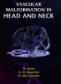 VASCULAR MALFORMATION IN HEAD AND NECK   Volum-1
