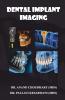 DENTAL IMPLANT IMAGING