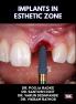 IMPLANTS IN ESTHETIC ZONE