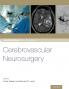 Cerebrovascular Neurosurgery