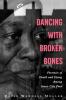 Dancing with Broken Bones