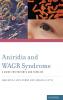 Aniridia and WAGR Syndrome