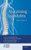 ANKYLOSING SPONDYLITIS C