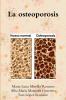 La osteoporosis