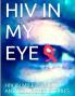 HIV in my Eye