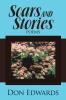 Scars and Stories