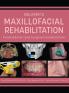 Beumer's Maxillofacial Rehabilitation