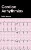 Cardiac Arrhythmias