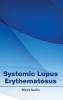 Systemic Lupus Erythematosus