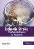Ischemic Stroke