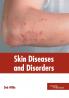 Skin Diseases and Disorders